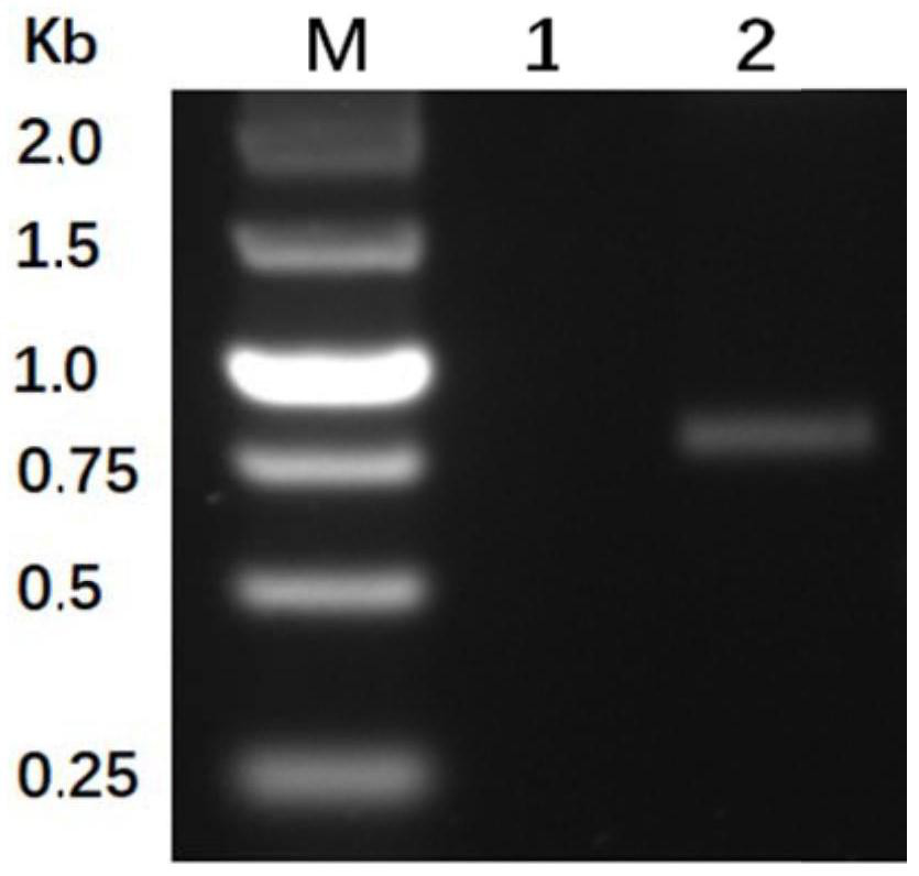Plasmid recombinant listeria monocytogenes as well as construction method and application thereof