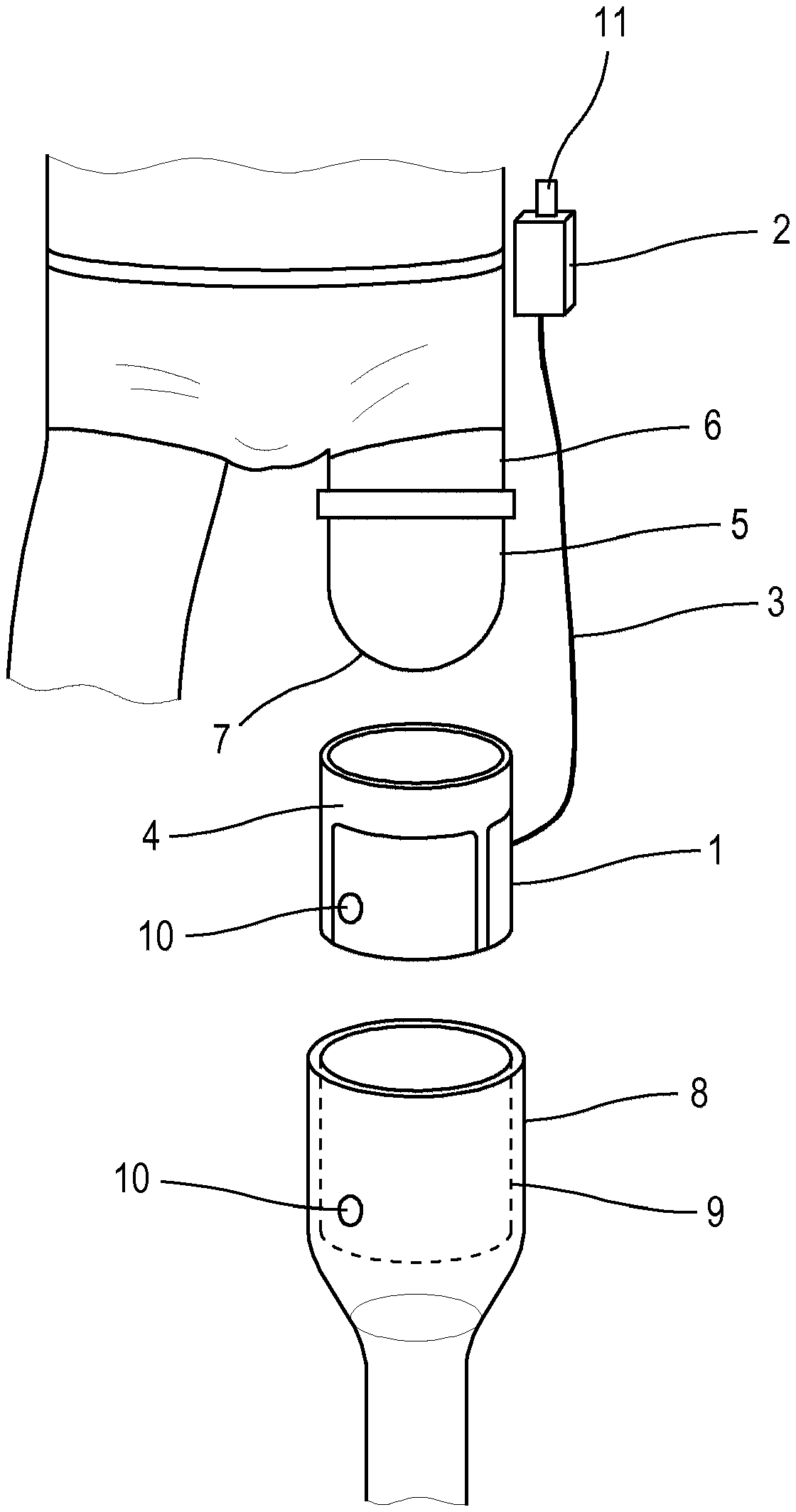 Device and method for the heating and/or temperature control of prosthesis sockets