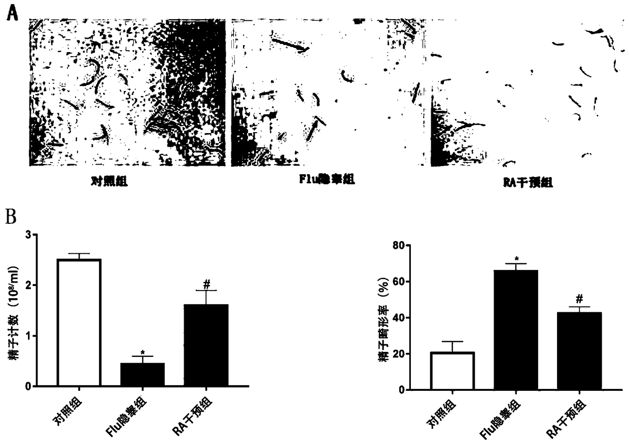 Application of retinoic acid in preparation of drugs for improving prognosis of cryptorchidism