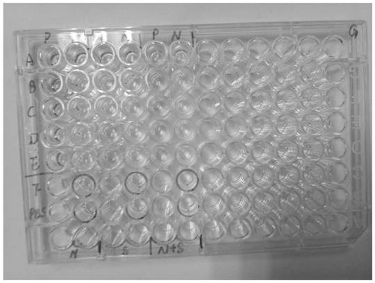 A rapid detection kit for novel coronavirus antibody based on mixed antigen