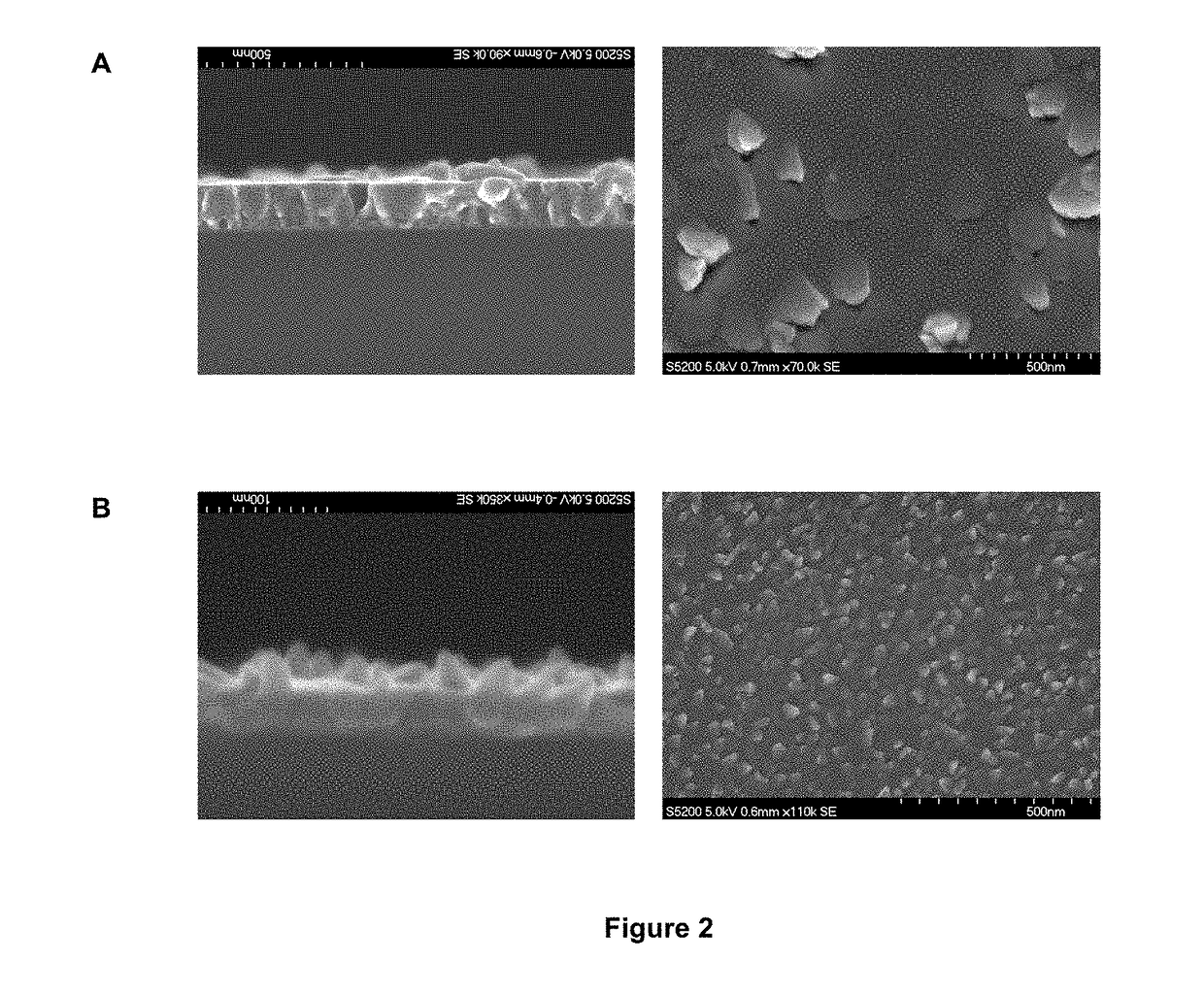Biocompatible implants made of nanostructured titanium with antibacterial properties