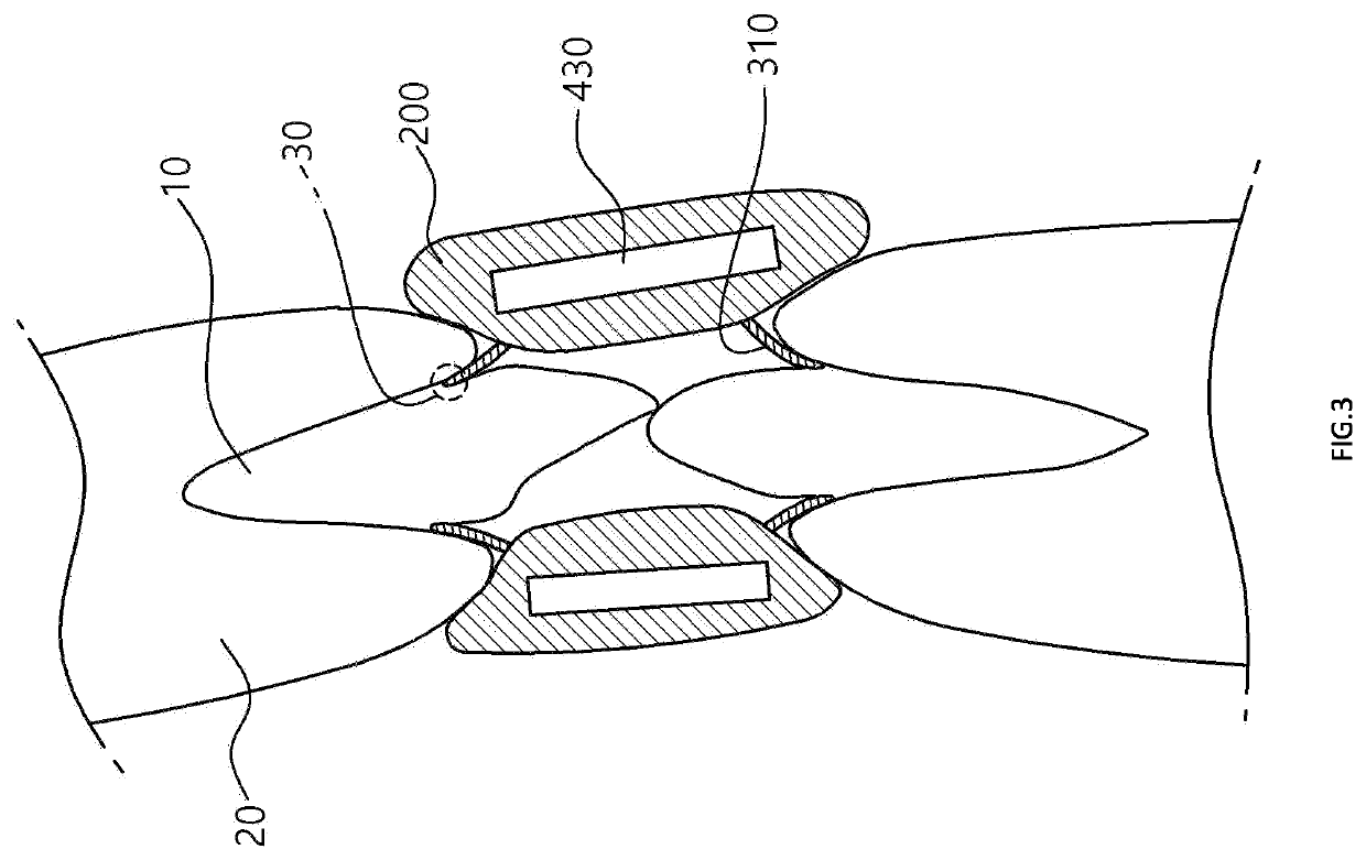 Periodontal pocket cleaning device for cleaning periodontal pockets by being inserted into periodontal pocket formed at boundary between teeth and gums, and method for manufacturing periodontal pocket cleaning device