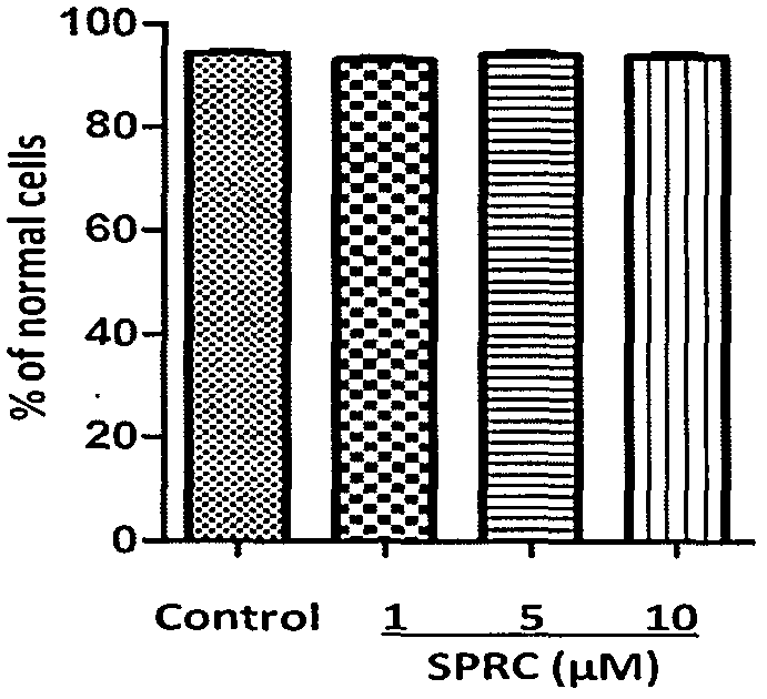 Application of S-propargyl-cysteine serving as hydrogen sulfide donor in drug preparation