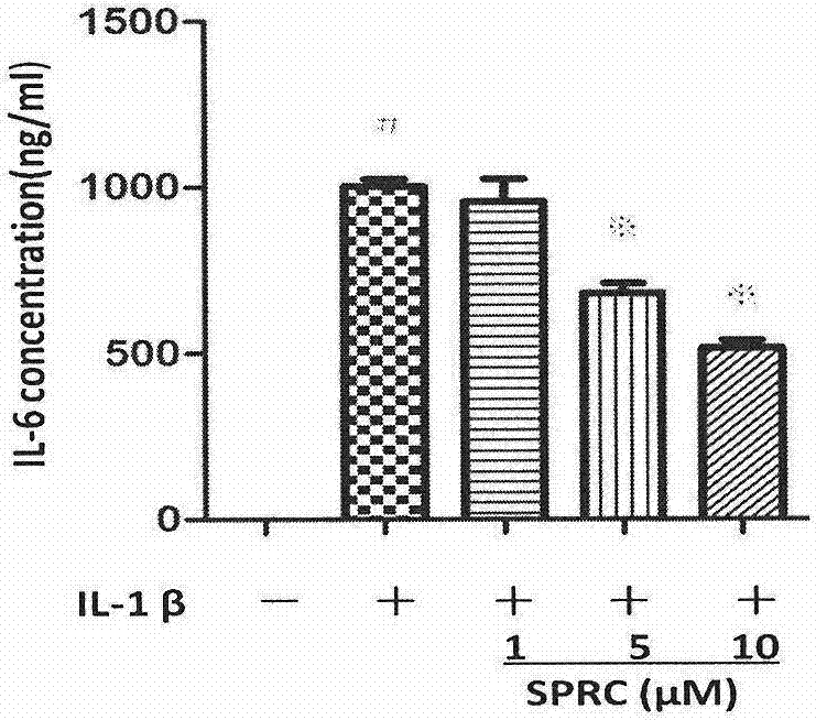 Application of S-propargyl-cysteine serving as hydrogen sulfide donor in drug preparation