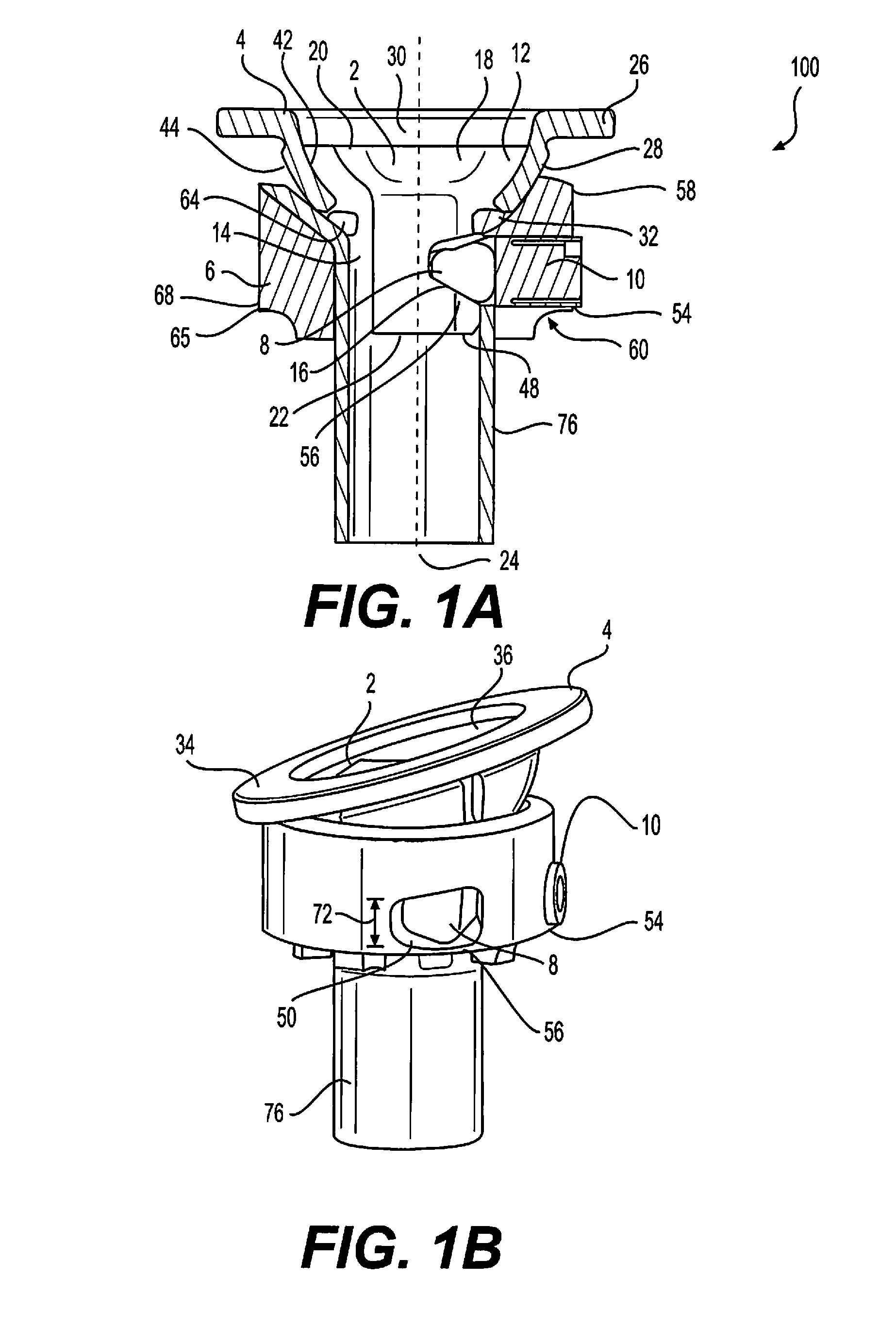 Vertebral implants and methods for installation thereof