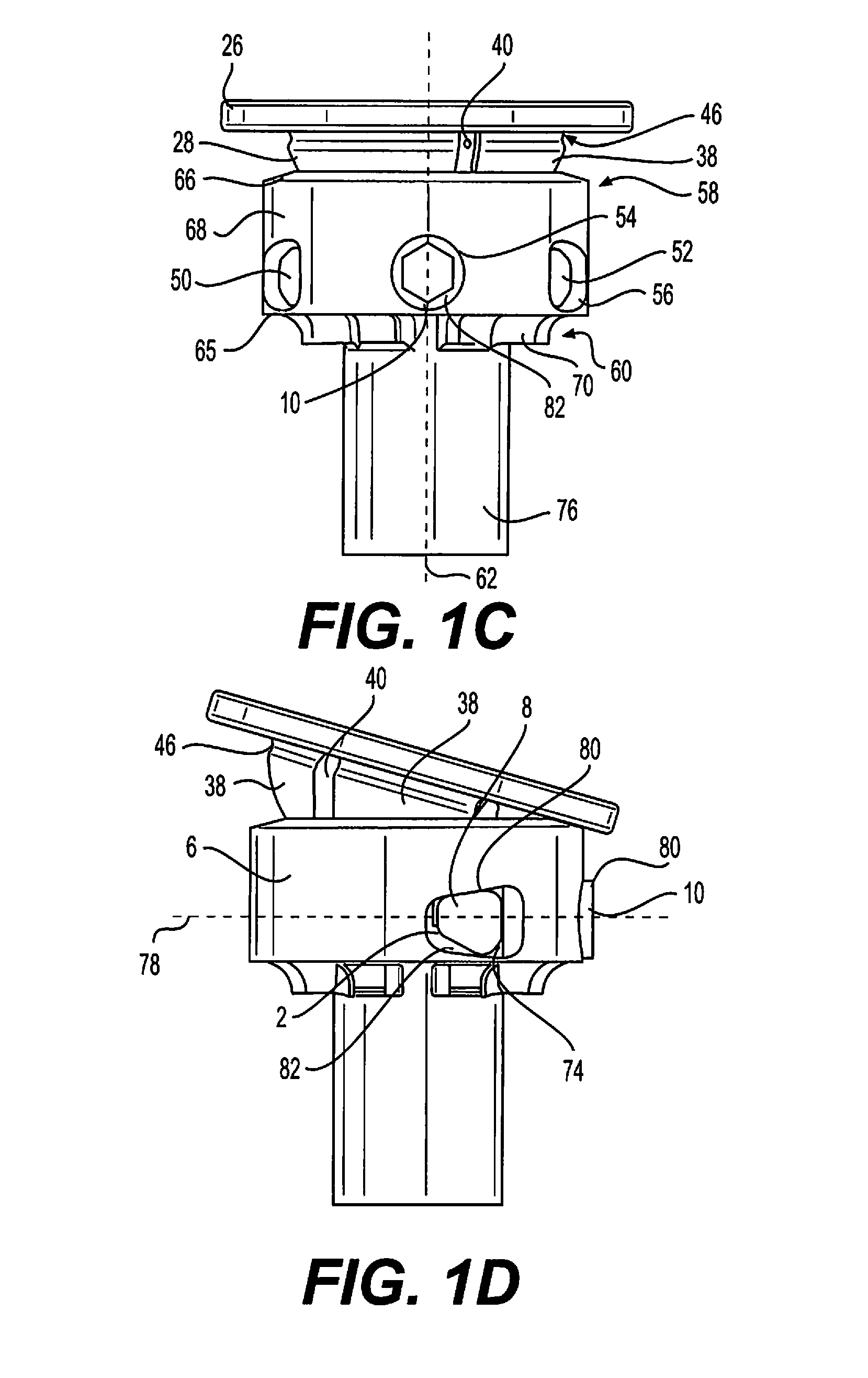 Vertebral implants and methods for installation thereof