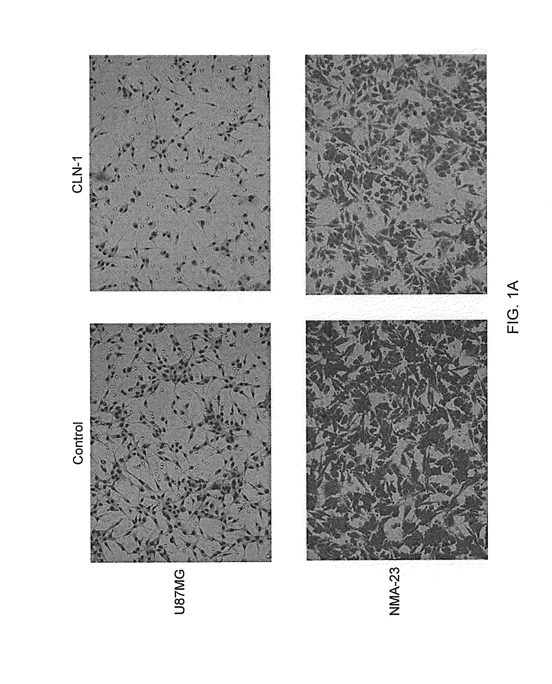 Compositions and Methods for Treating Brain Tumors