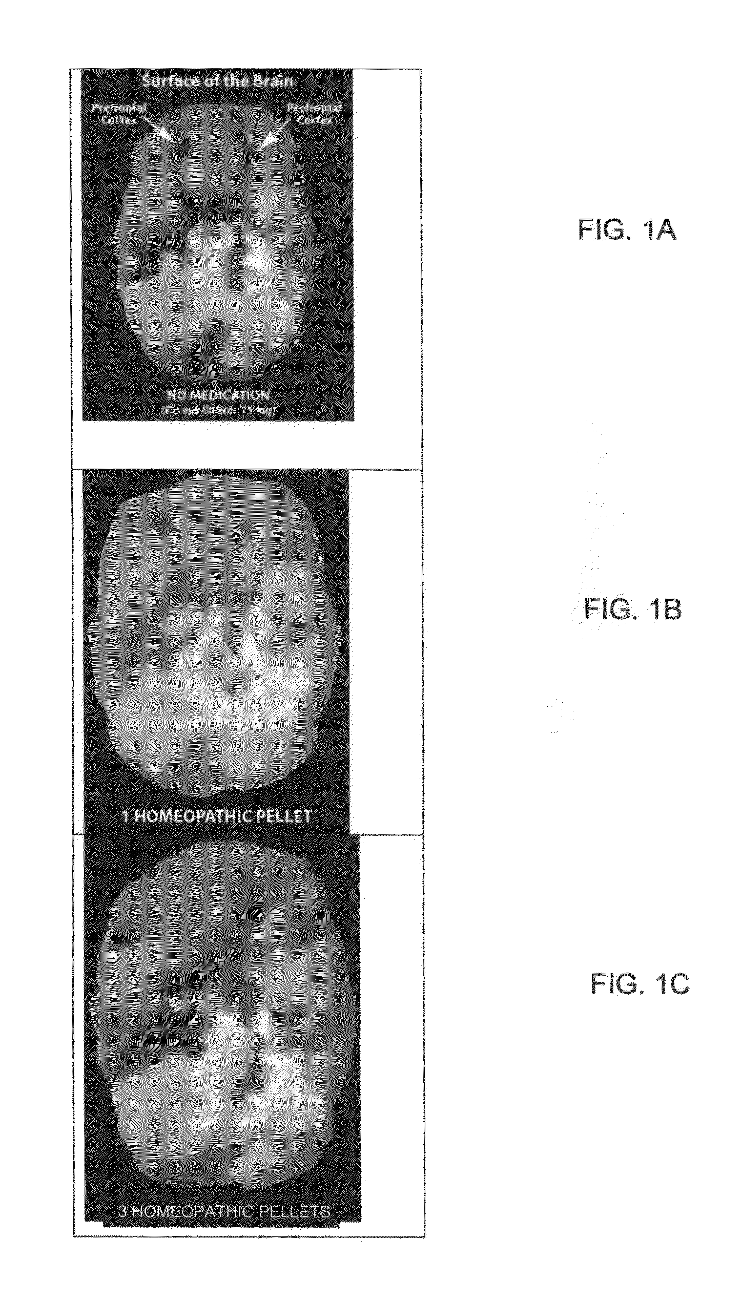 Methods and compositions for treatment of add/adhd, depression, memory problems and other conditions