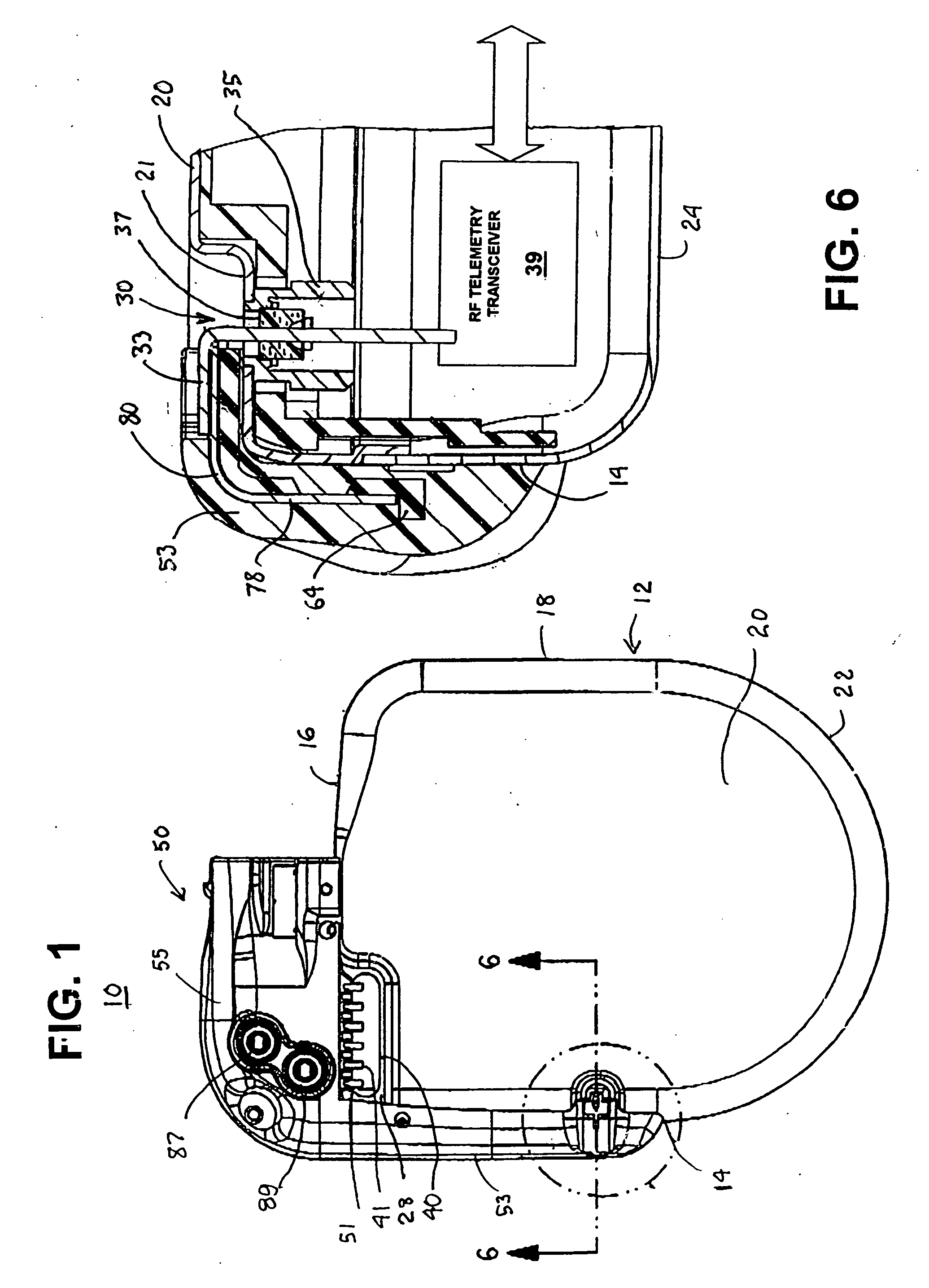 Telemetry antenna for an implantable medical device