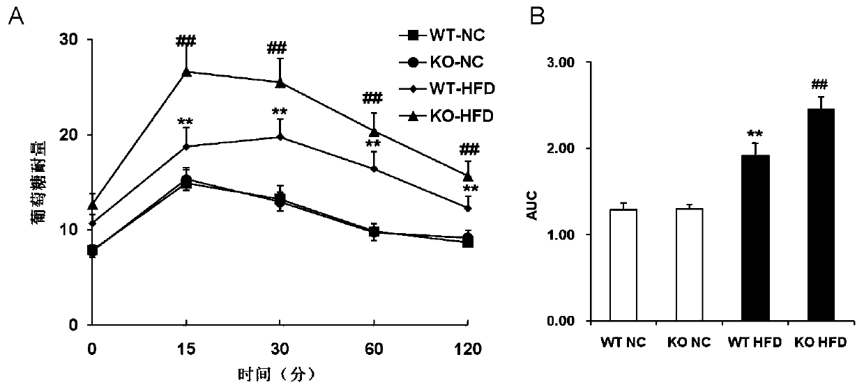 Function and application of dual specificity phosphatase 14 in the treatment of non-alcoholic fatty liver disease and type Ⅱ diabetes