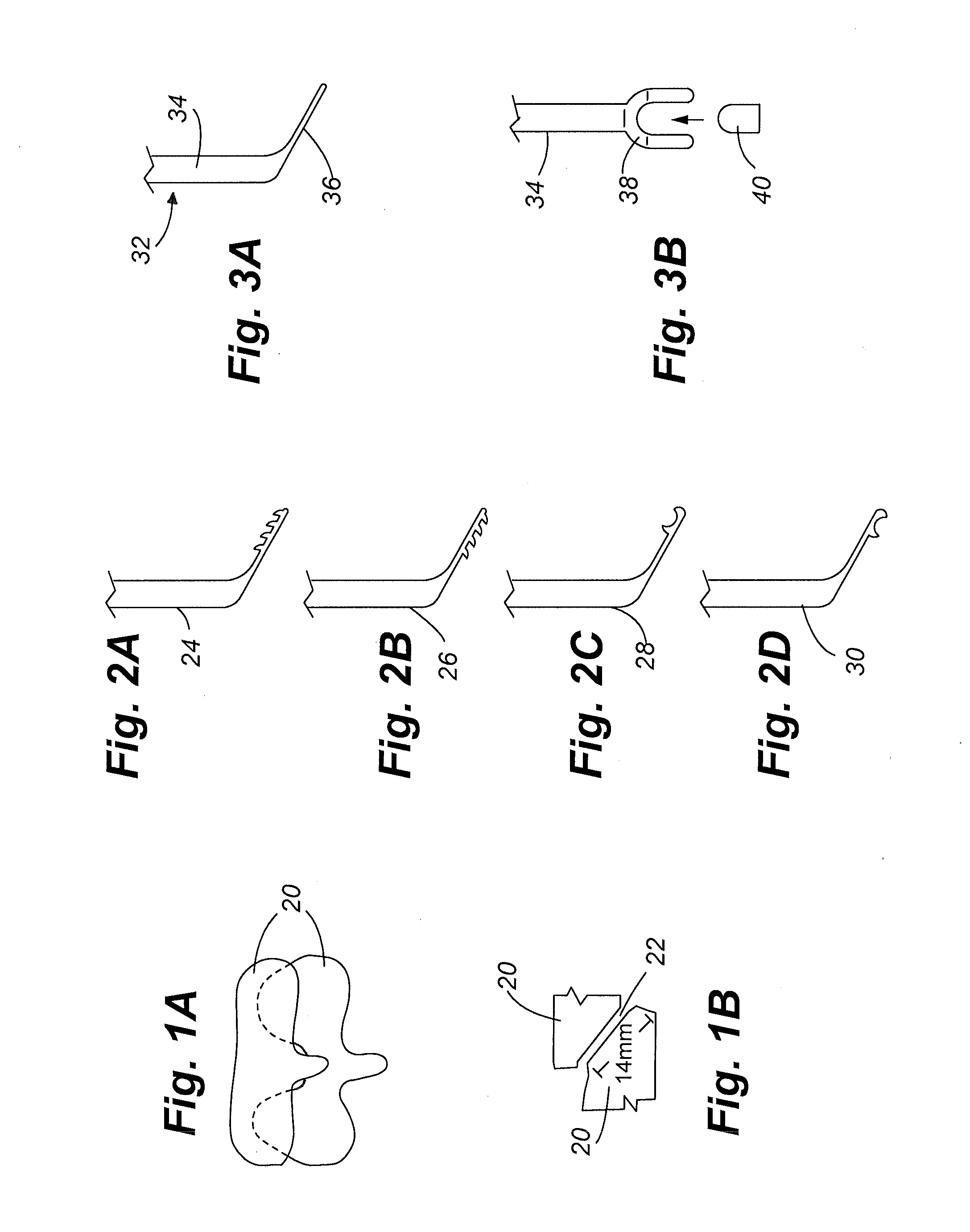 Apparatus and method of spinal implant and fusion