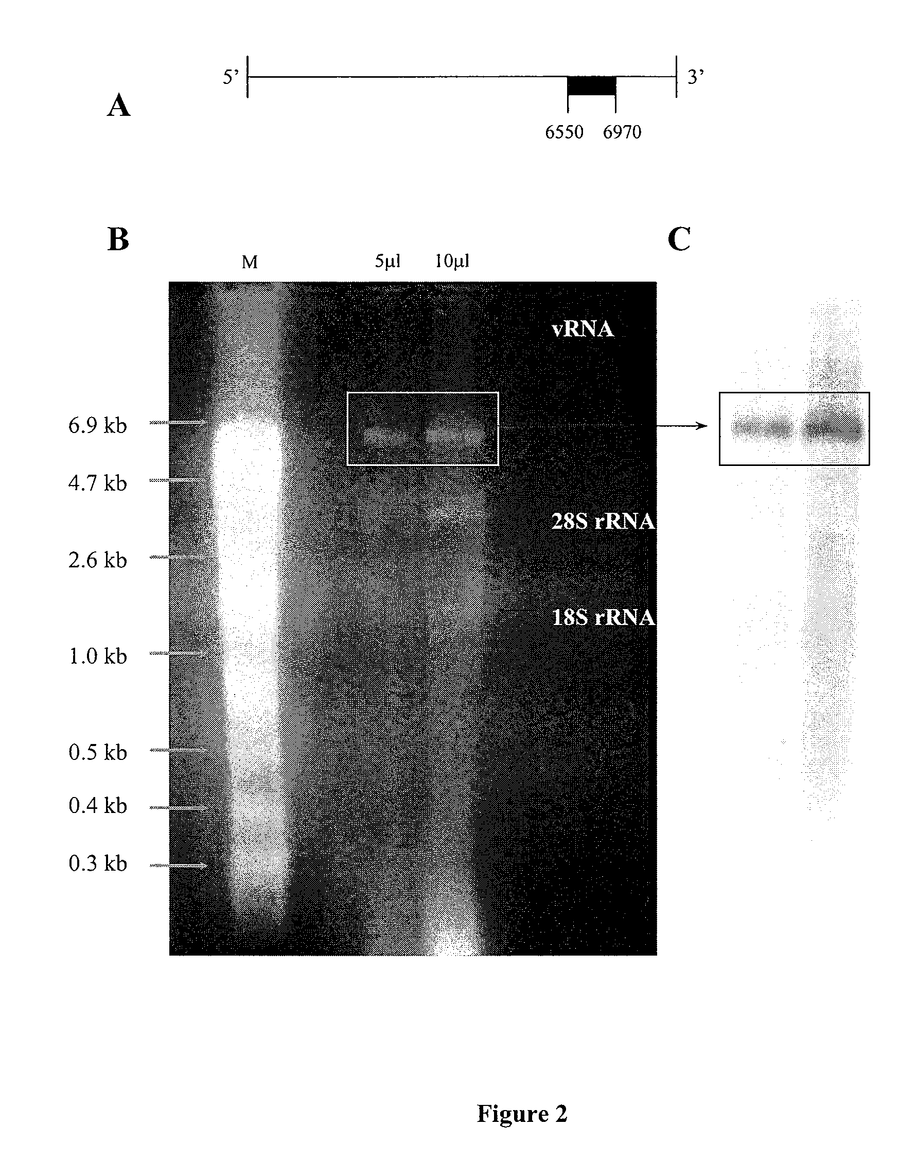 Method and composition for treatment of neoplasms