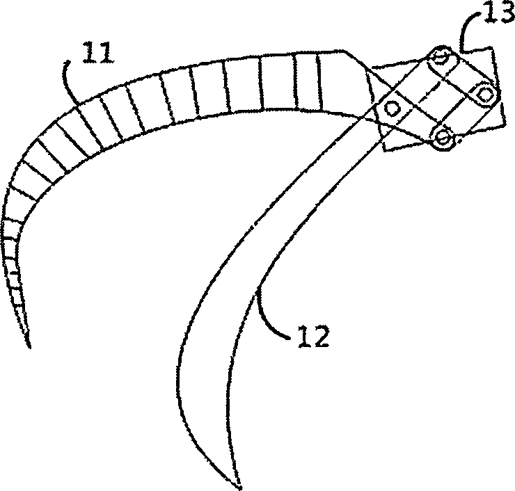 Inferior vena cava root blood vessel anatomic separating forceps applied to laparotomy