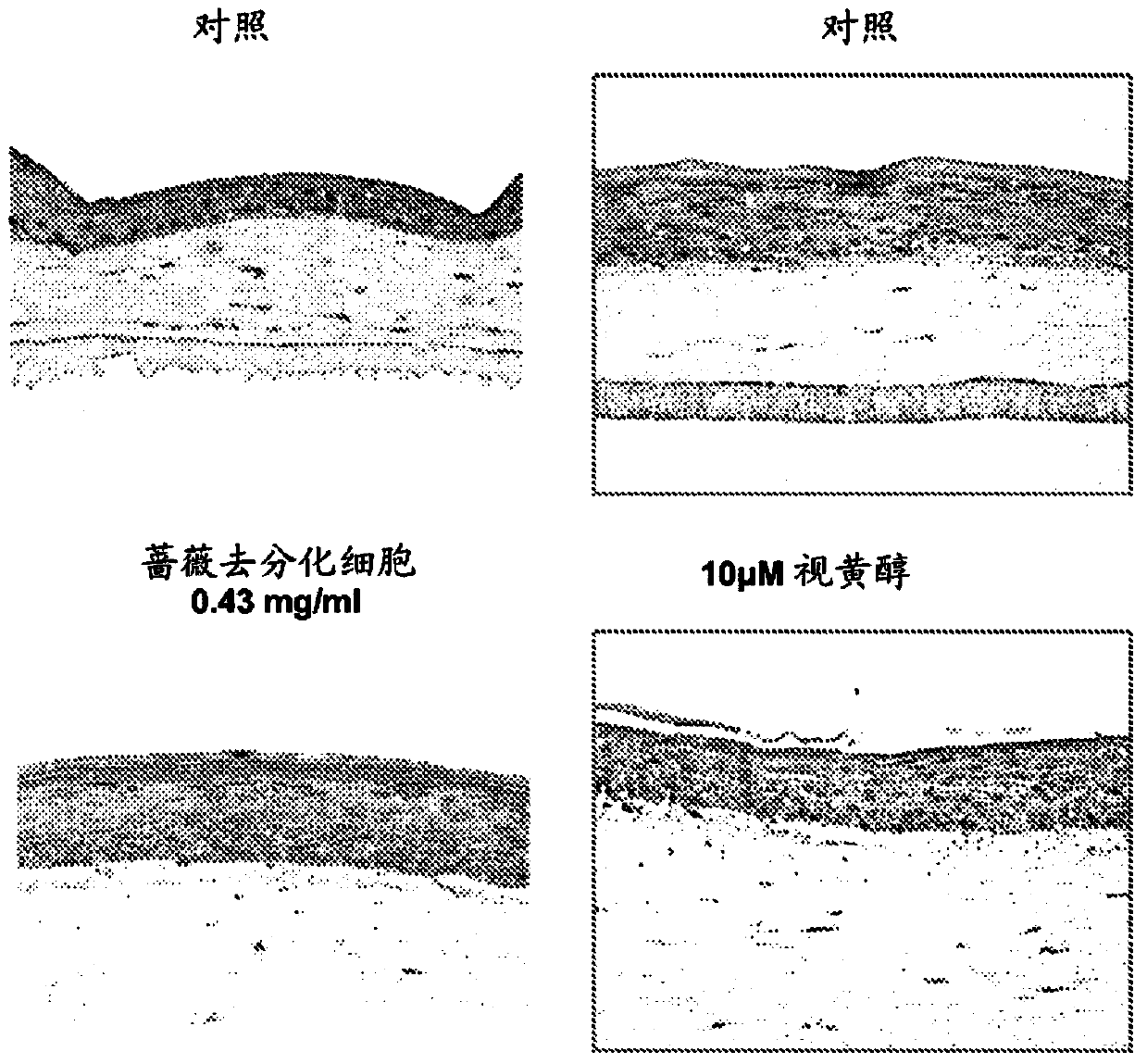 Cosmetic uses of dedifferentiated plant cells