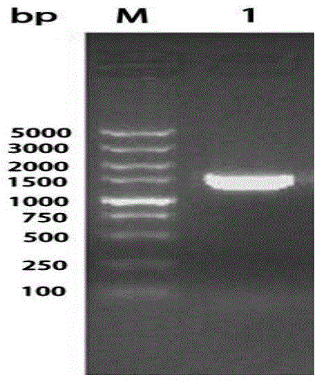 Riemerella anatipestifer OmpA/MotB signal peptide-removal recombinant protein, antibody and preparation method and application thereof