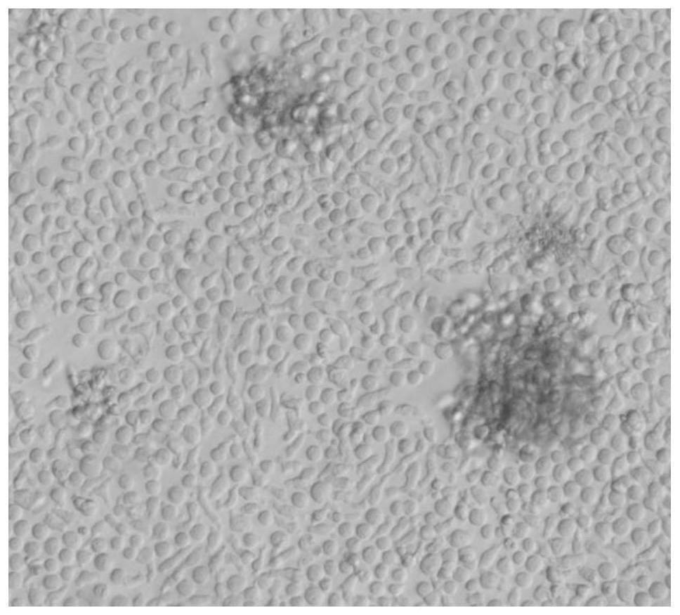 Gamma delta T-like alpha beta T cell and preparation method and application thereof