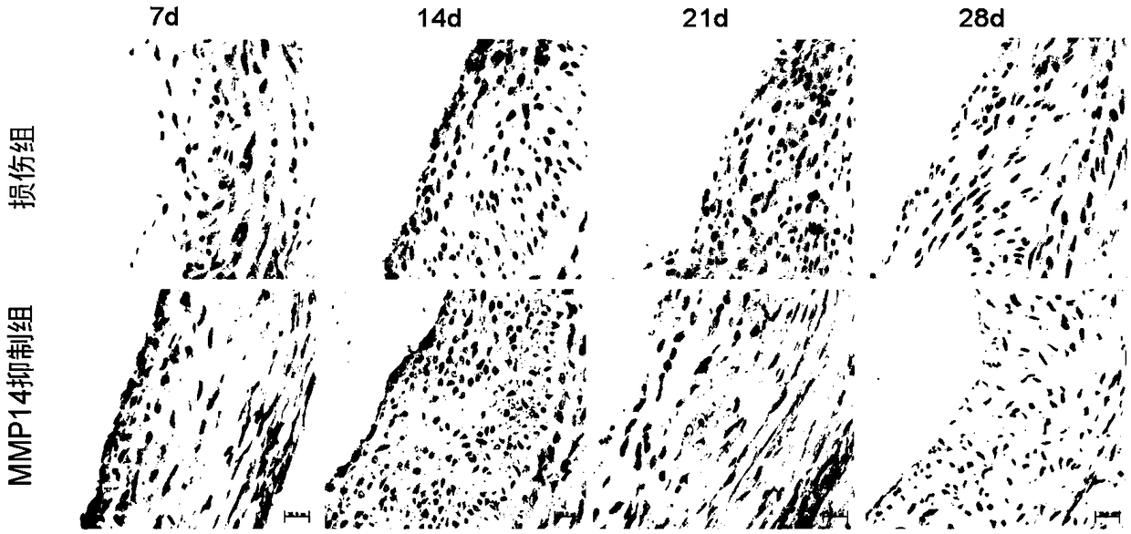 Application of MMP-14 inhibitor in preparation of medicines for treating blood vessel injury