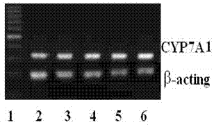 Compound traditional Chinese medicine extract for preventing and treating lipid metabolism disorder and preparation method thereof