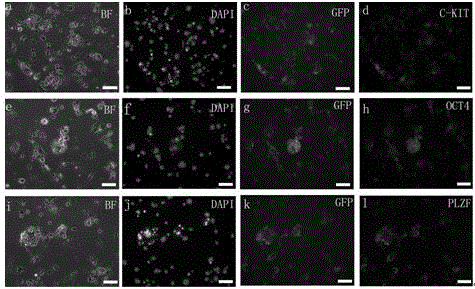 Method for efficiently separating mouse spermatogonial stem cells