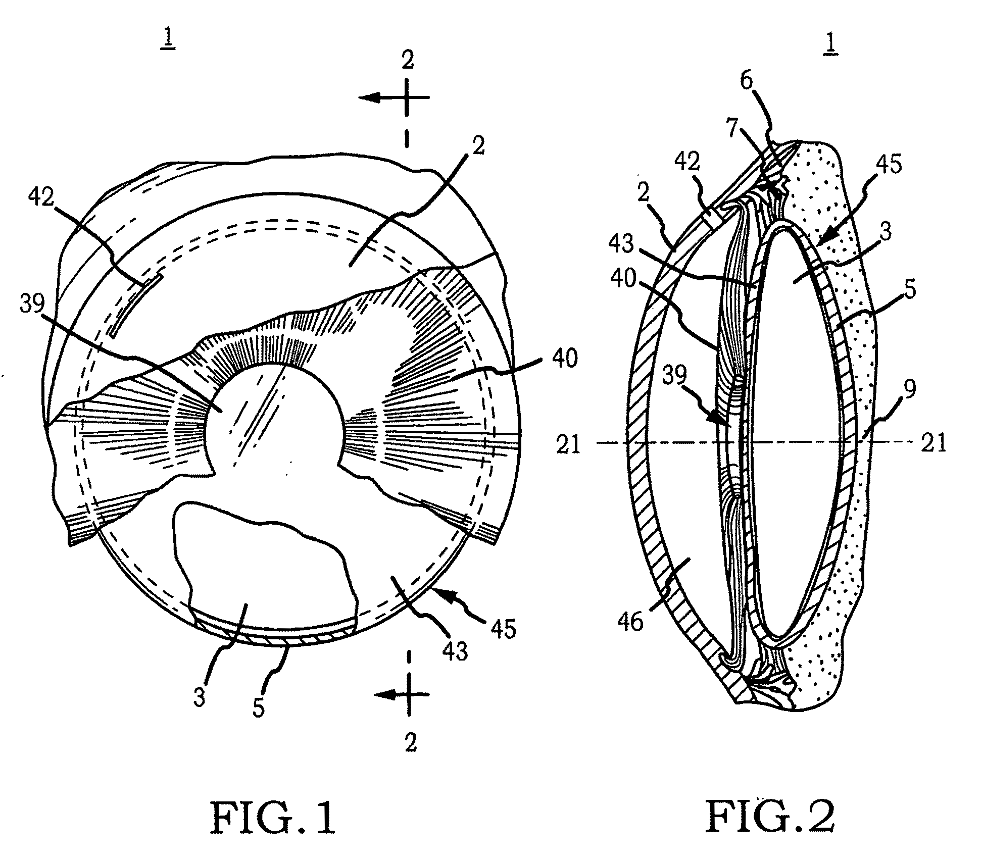 Intraocular implant cell migration inhibition system