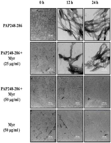 New uses of myricetin and its derivatives and a microbicide against HIV infection