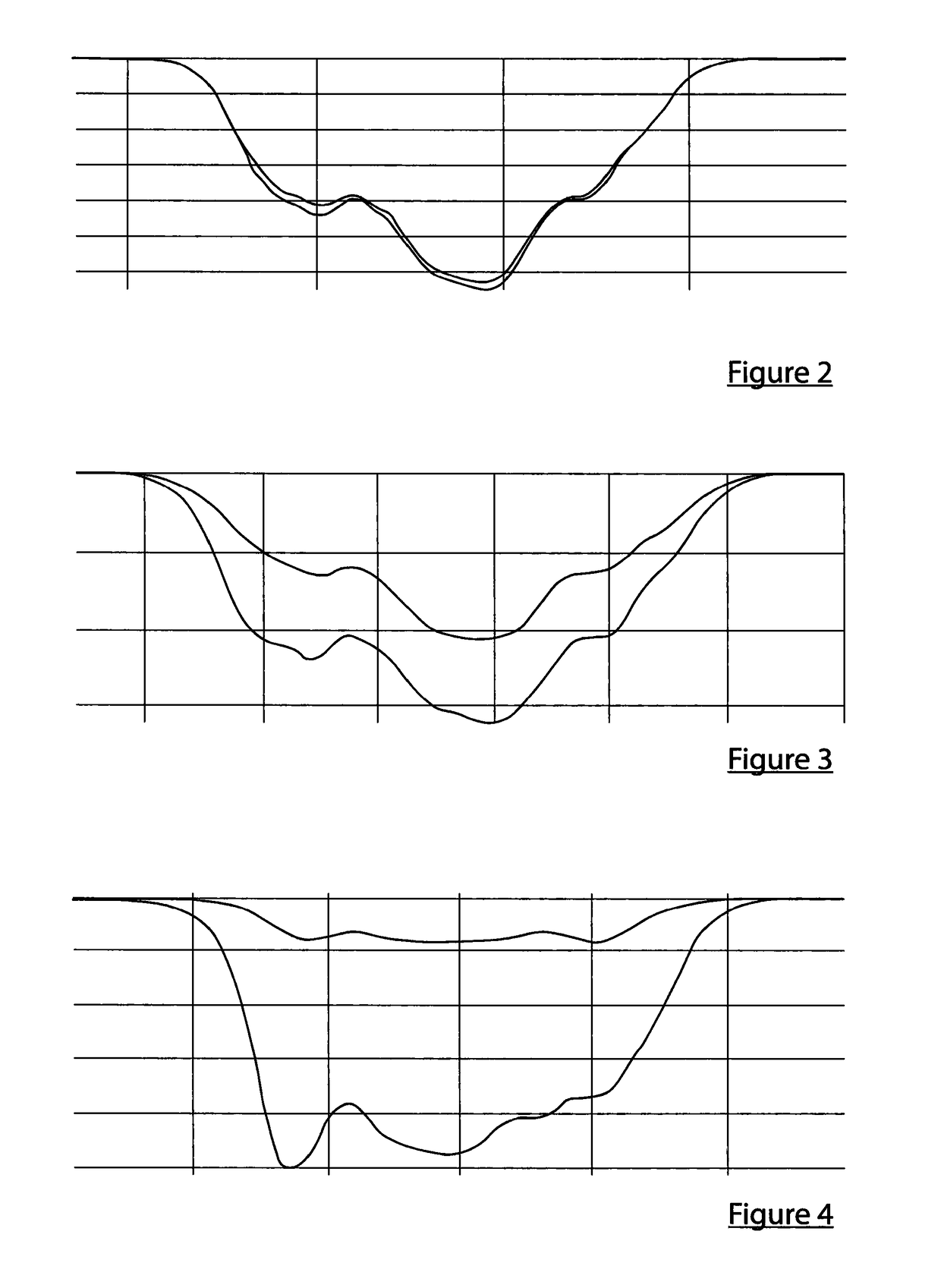 Vehicle detection apparatus