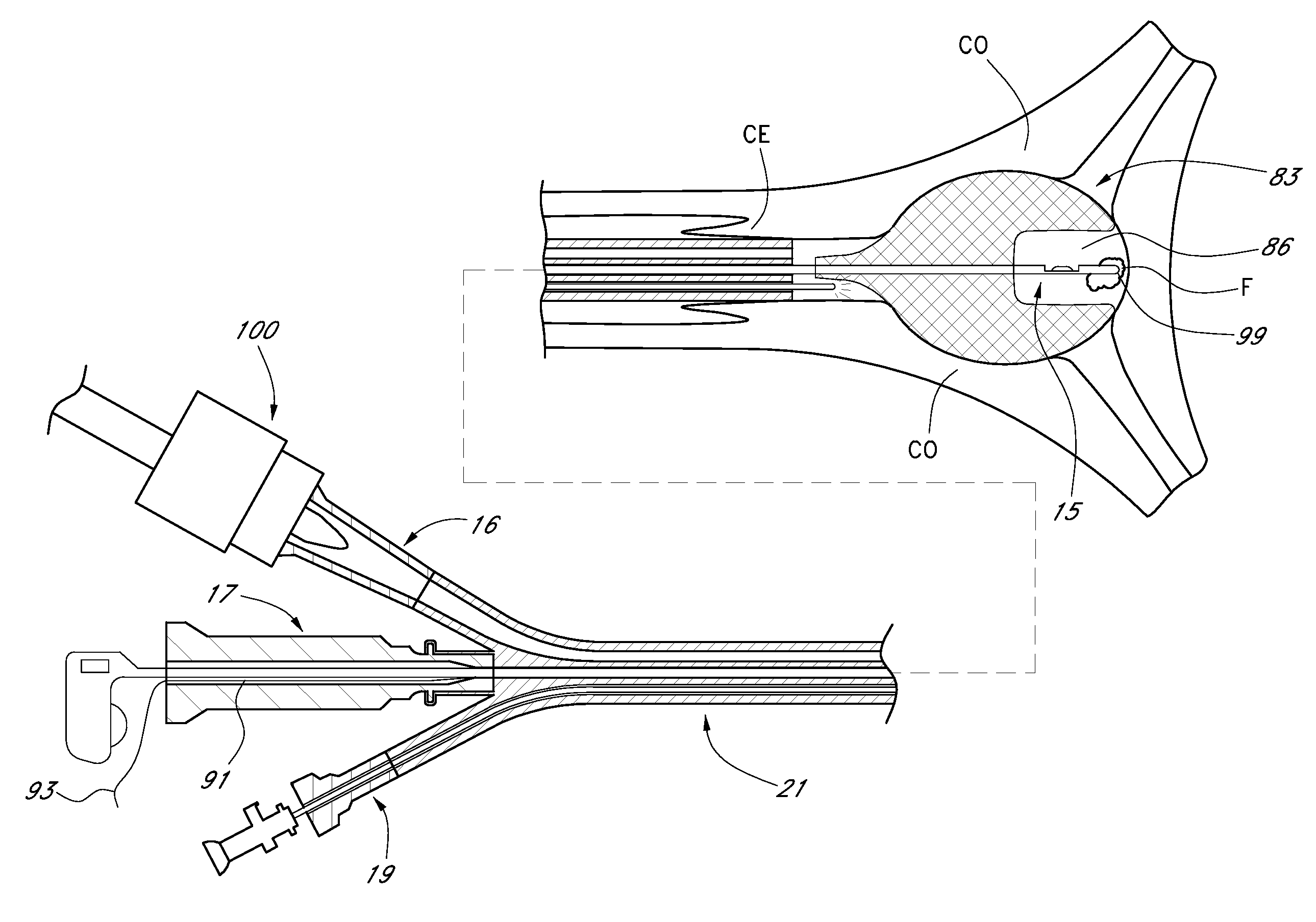 Methods for performing a medical procedure
