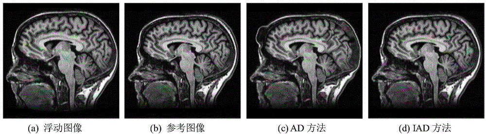 Non-rigid registration method applied to medical image