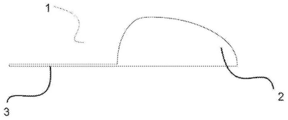 Container device for breast prosthesis for breast reconstruction surgery