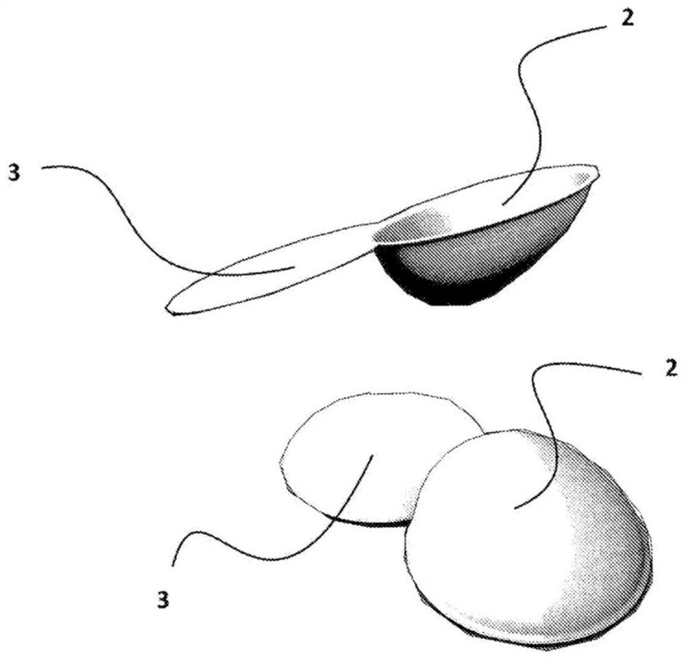 Container device for breast prosthesis for breast reconstruction surgery