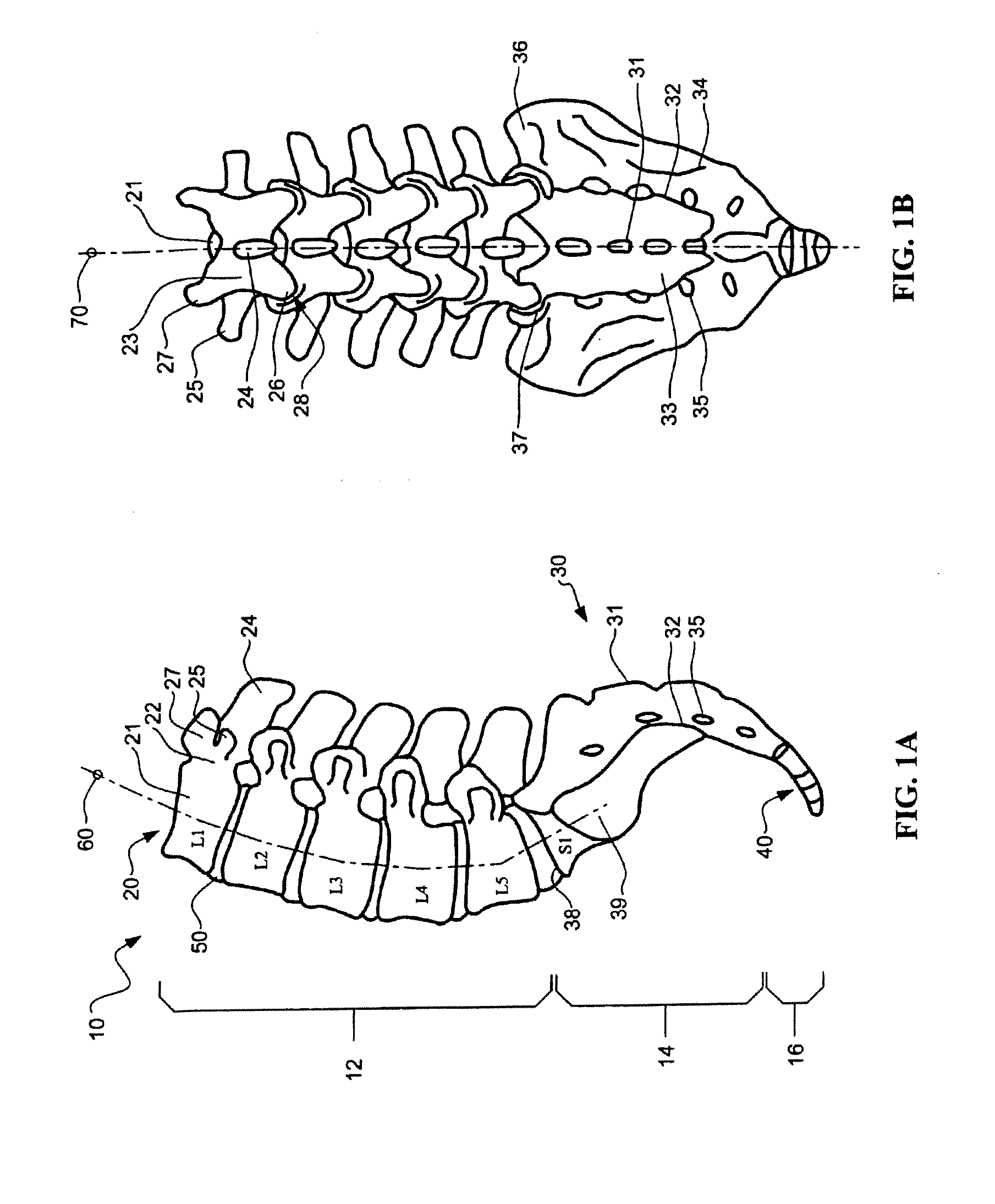 Devices and Methods for Annular Repair of Intervertebral Discs