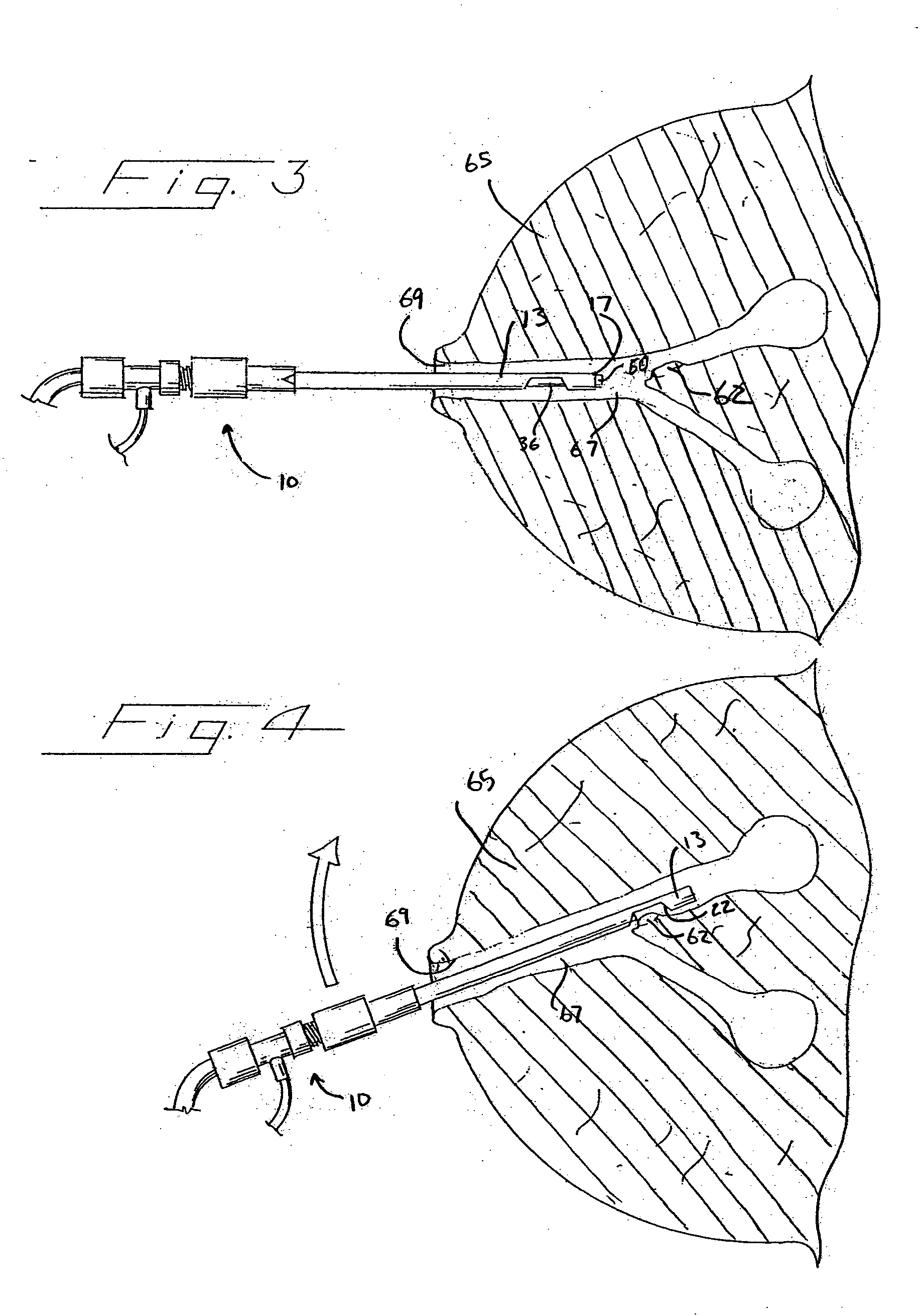 Biopsy device with viewing assembly