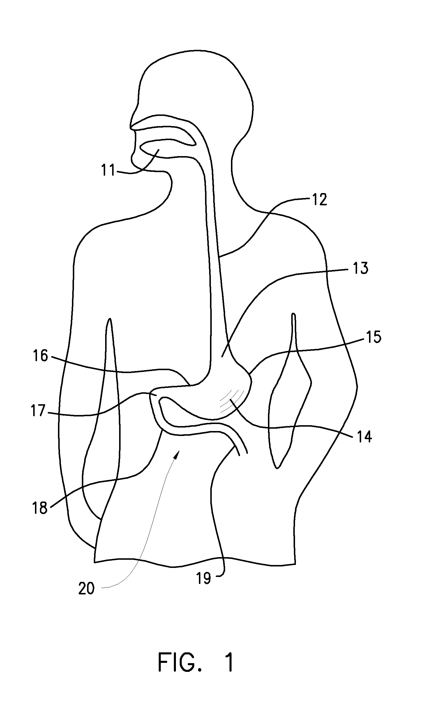 Methods And Apparatus For The Treatment Of Metabolic Disorders