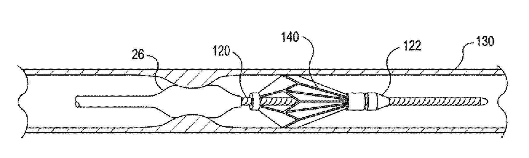 Method of providing embolic protection and shockwave angioplasty therapy to a vessel