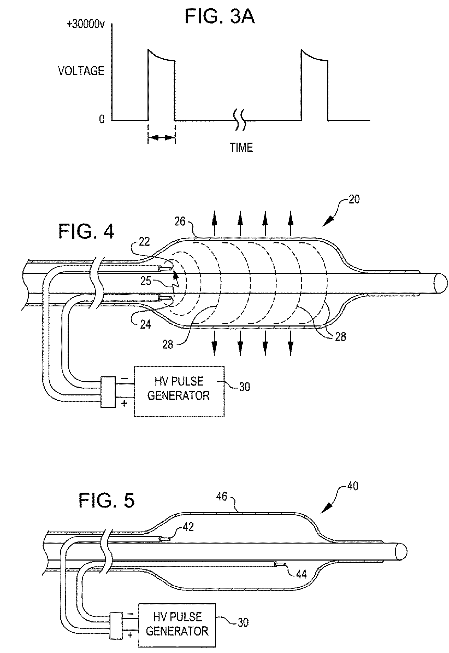 Method of providing embolic protection and shockwave angioplasty therapy to a vessel