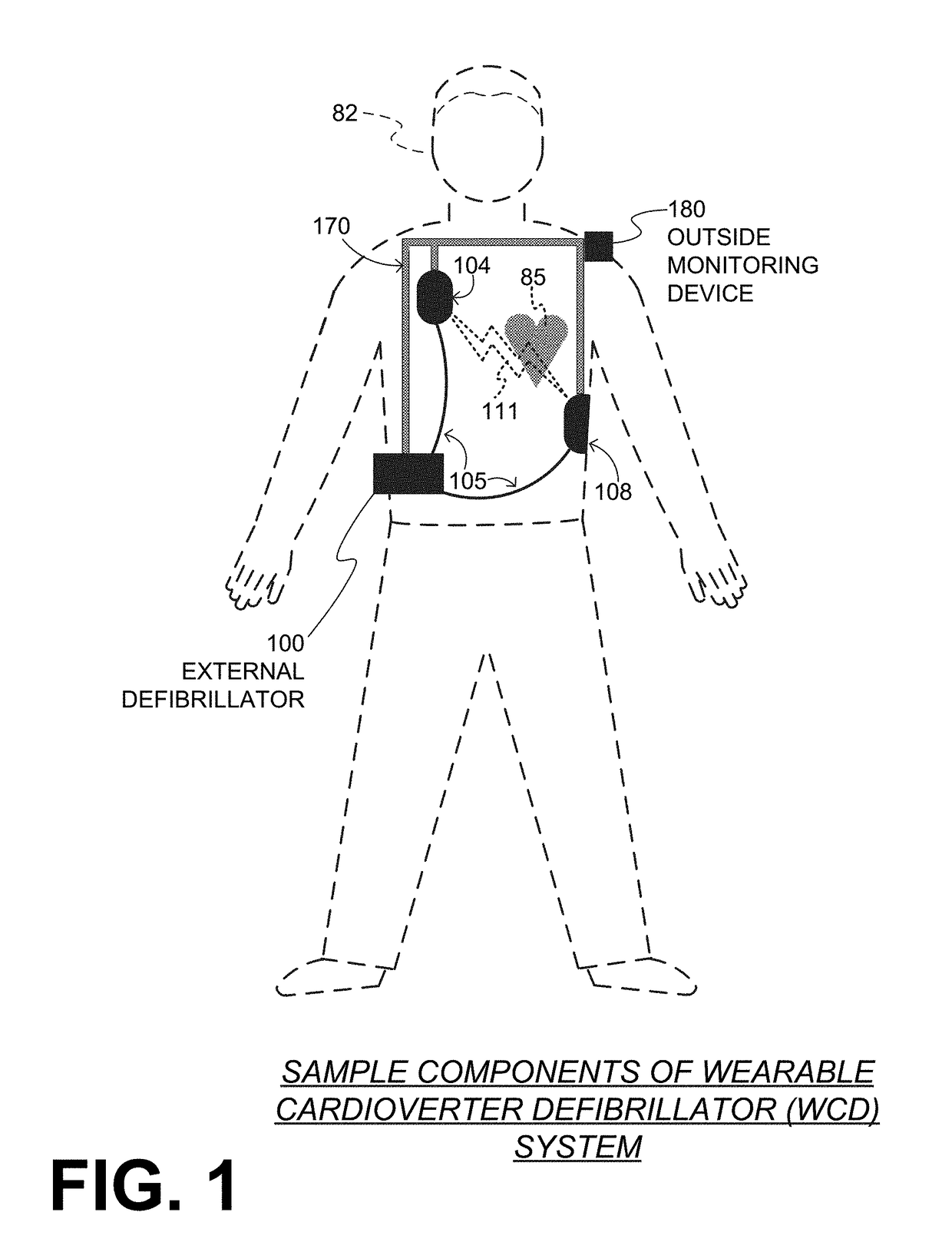 Wearable cardioverter defibrillator (WCD) system measuring patient's respiration