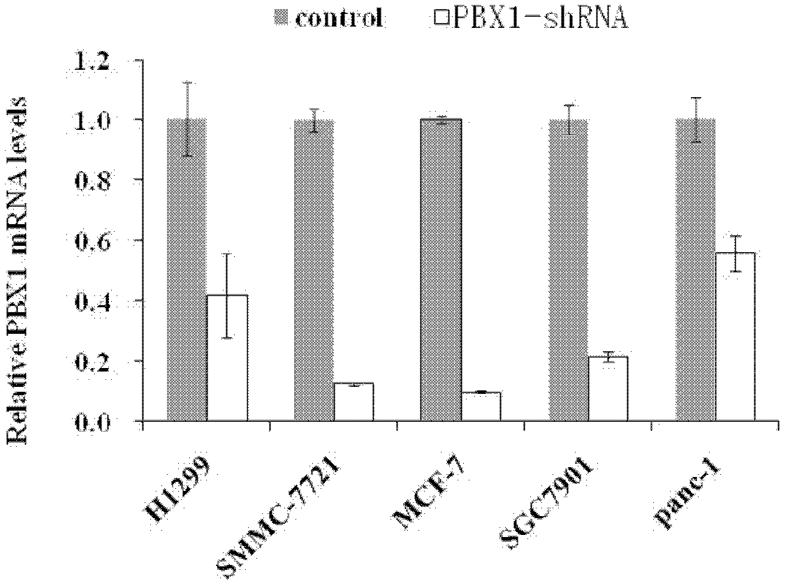 Applications of human pre-B-cell leukemia homeobox 1 (PBX1) gene and related drugs thereof