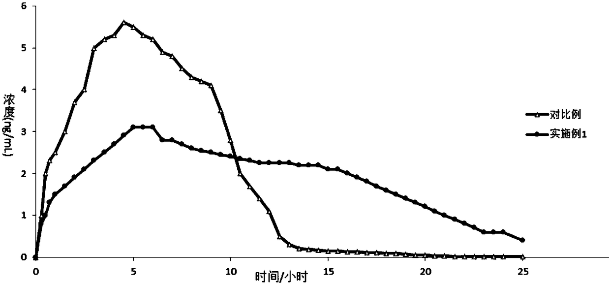 Tizanidine hydrochloride sustained-release preparation, preparation process and uses thereof
