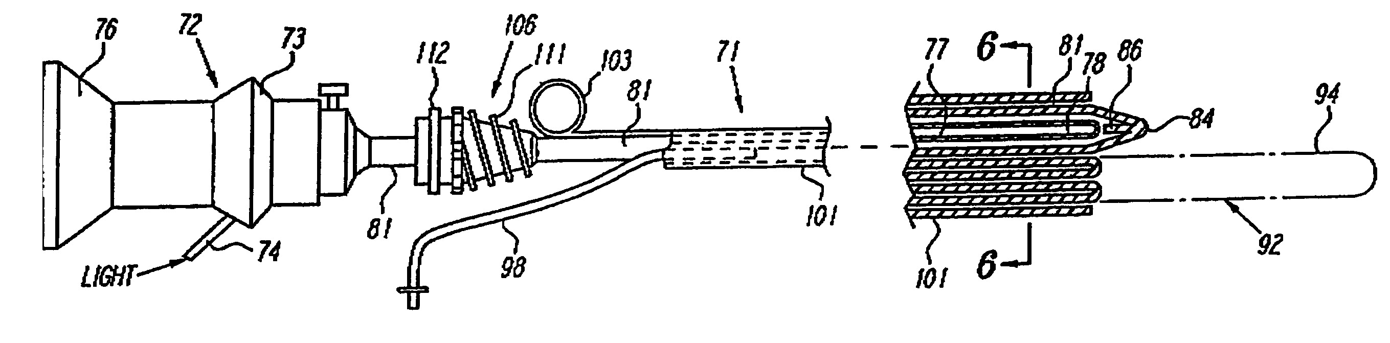 Extraluminal balloon dissection