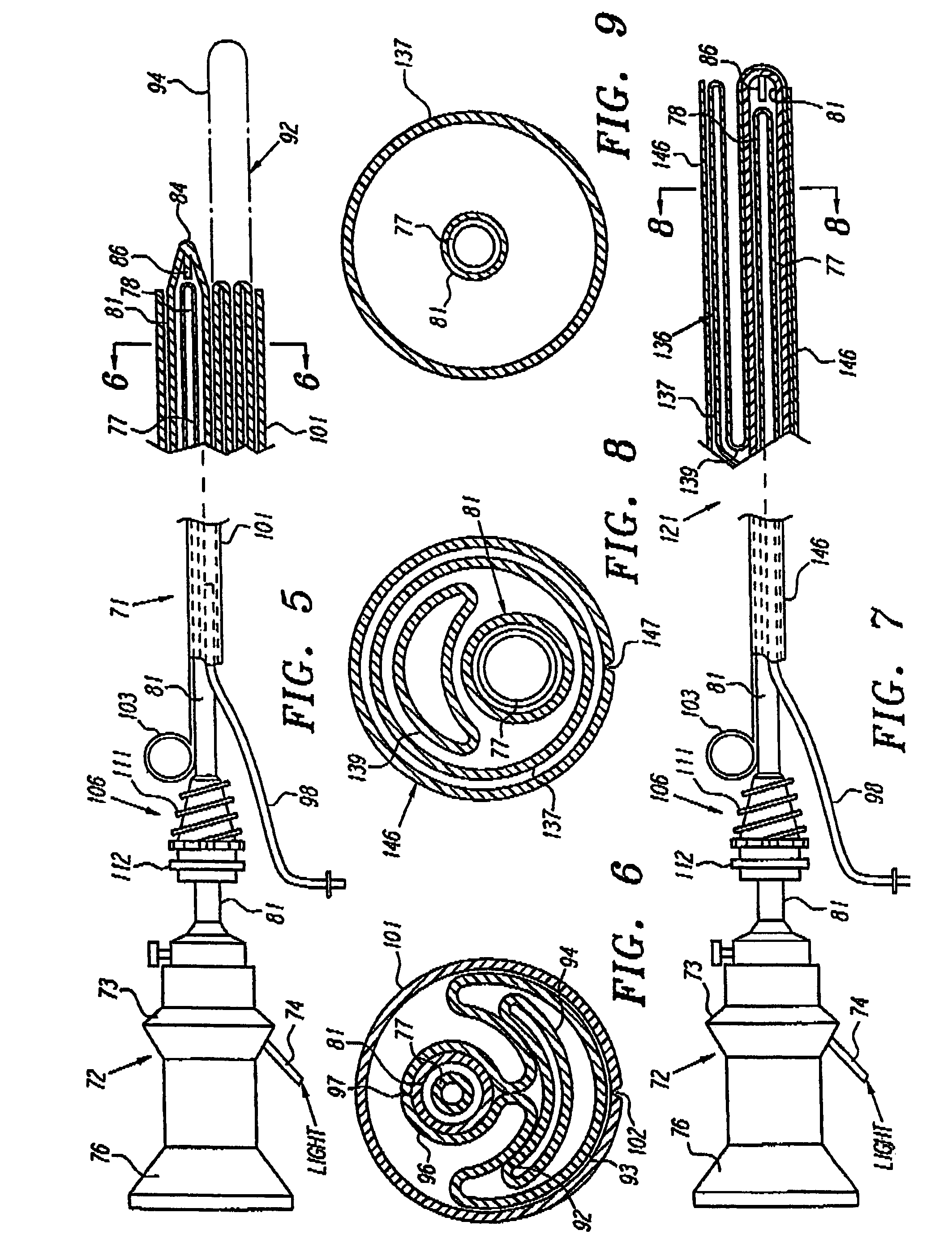 Extraluminal balloon dissection