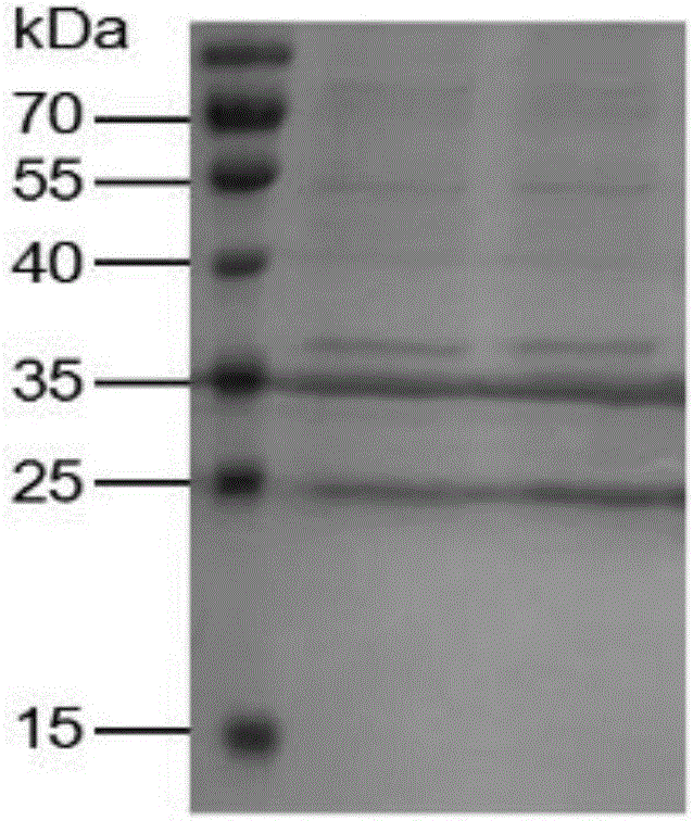 Recombinant interferon lambda 4 encoded cDNA sequence as well as preparation method and application thereof