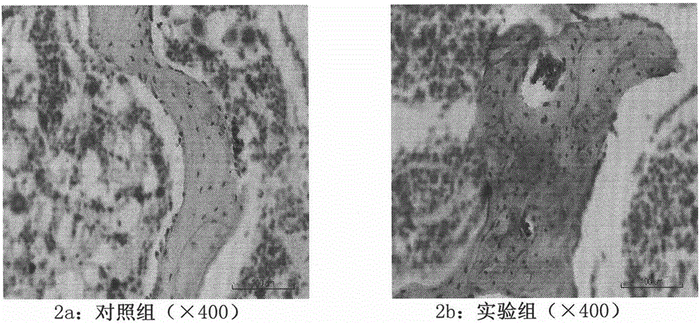 A method for expressing beclin1 and map1-lc3 in steroid-induced avascular necrosis of the femoral head in rabbits