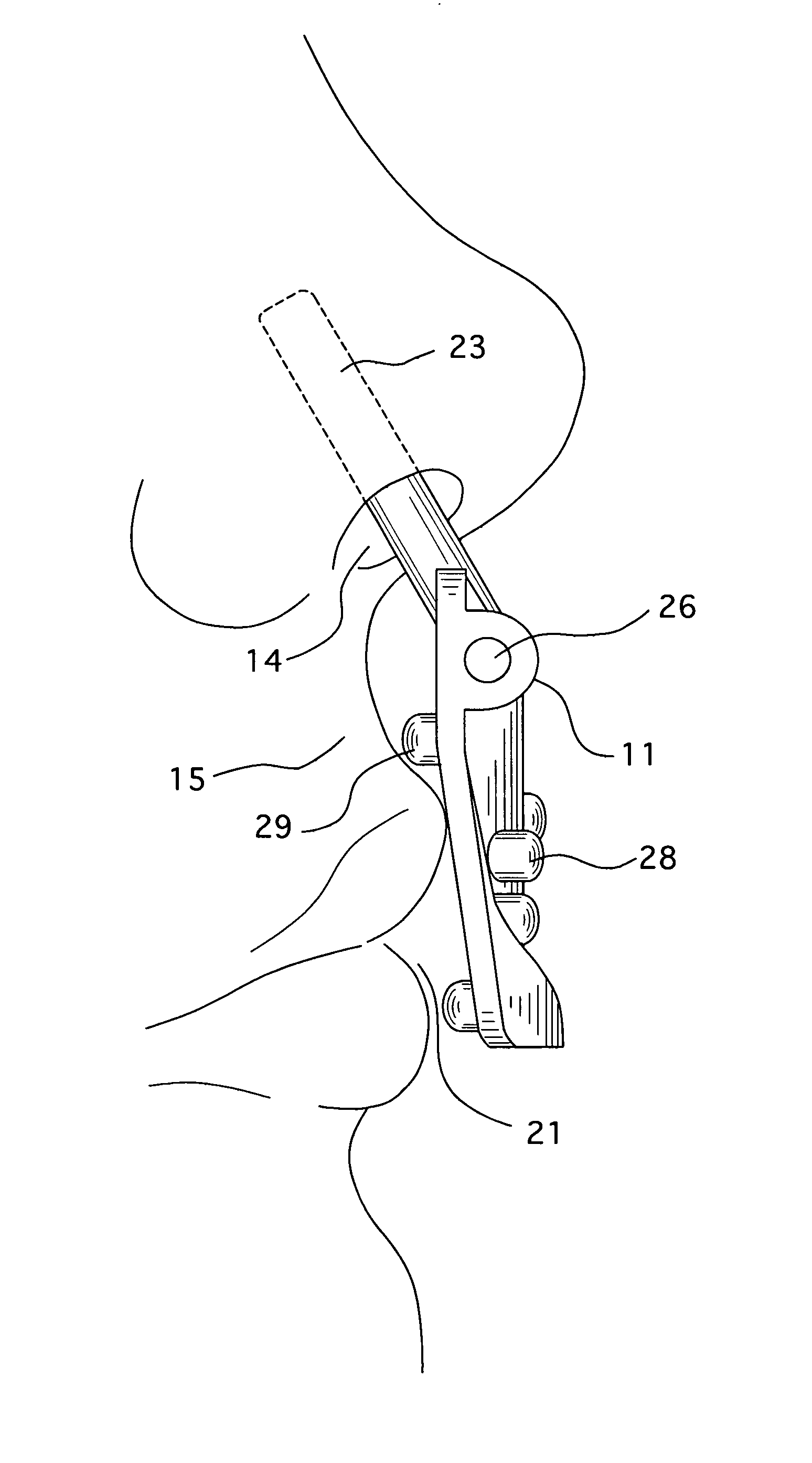 Oral/nasal cannula manifold