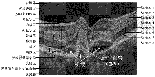OCT (Optical Coherence Tomography) image layer segmentation method based on neural network and constraint graph search algorithm