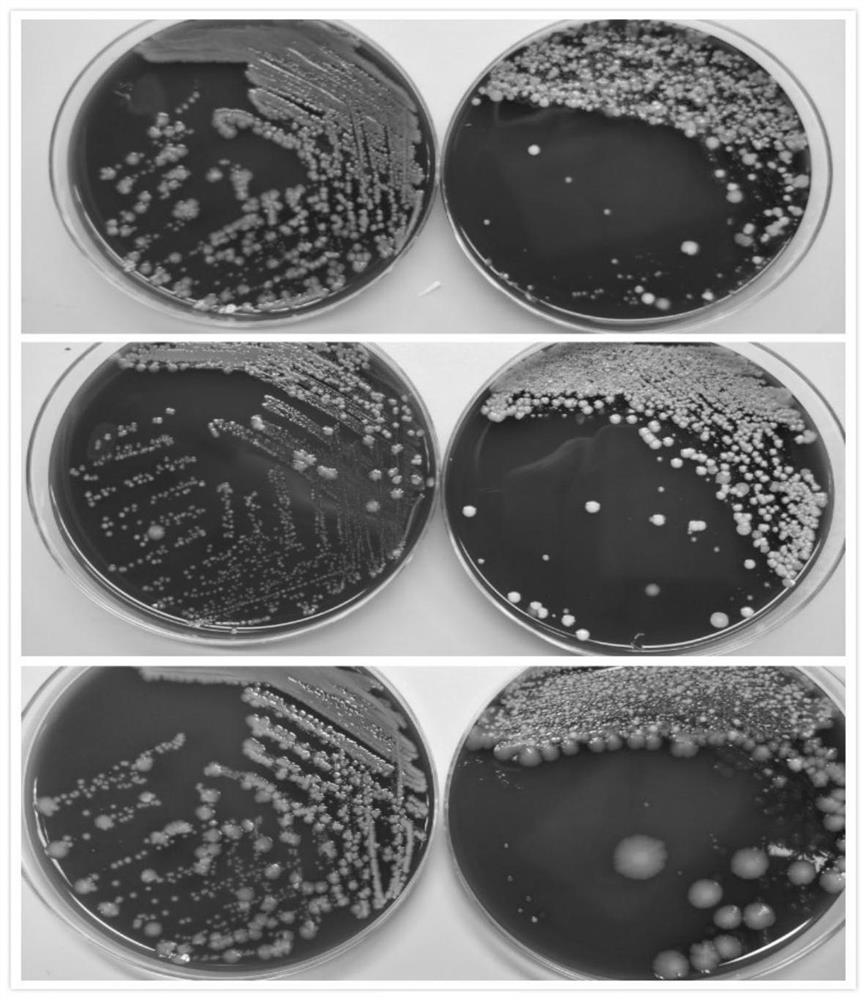 Group B Streptococcus Enrichment Broth and Its Application