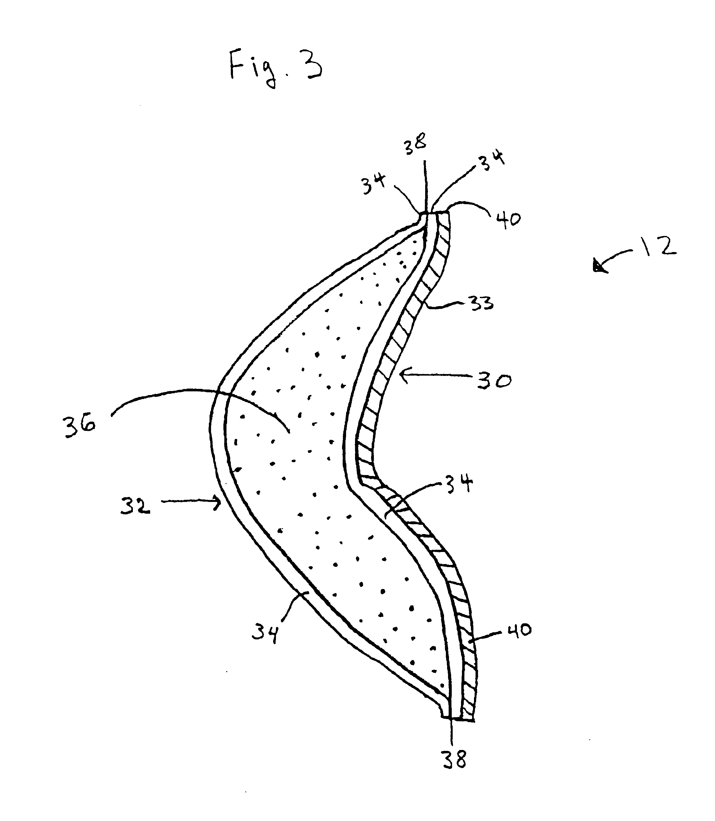 Attachable breast form enhancement system