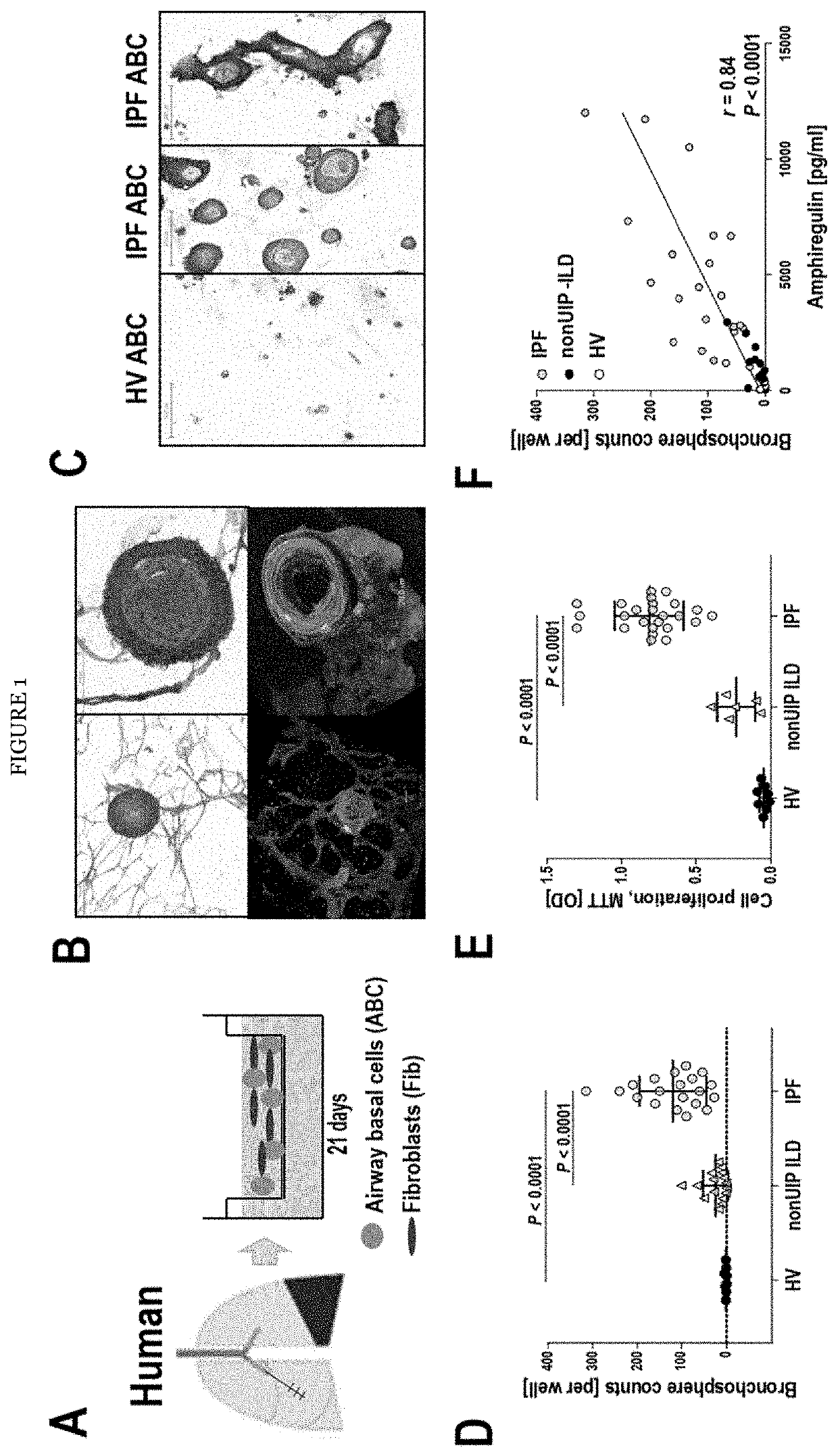 Modulators of airway basal cells for the treatment or prevention of lung diseases