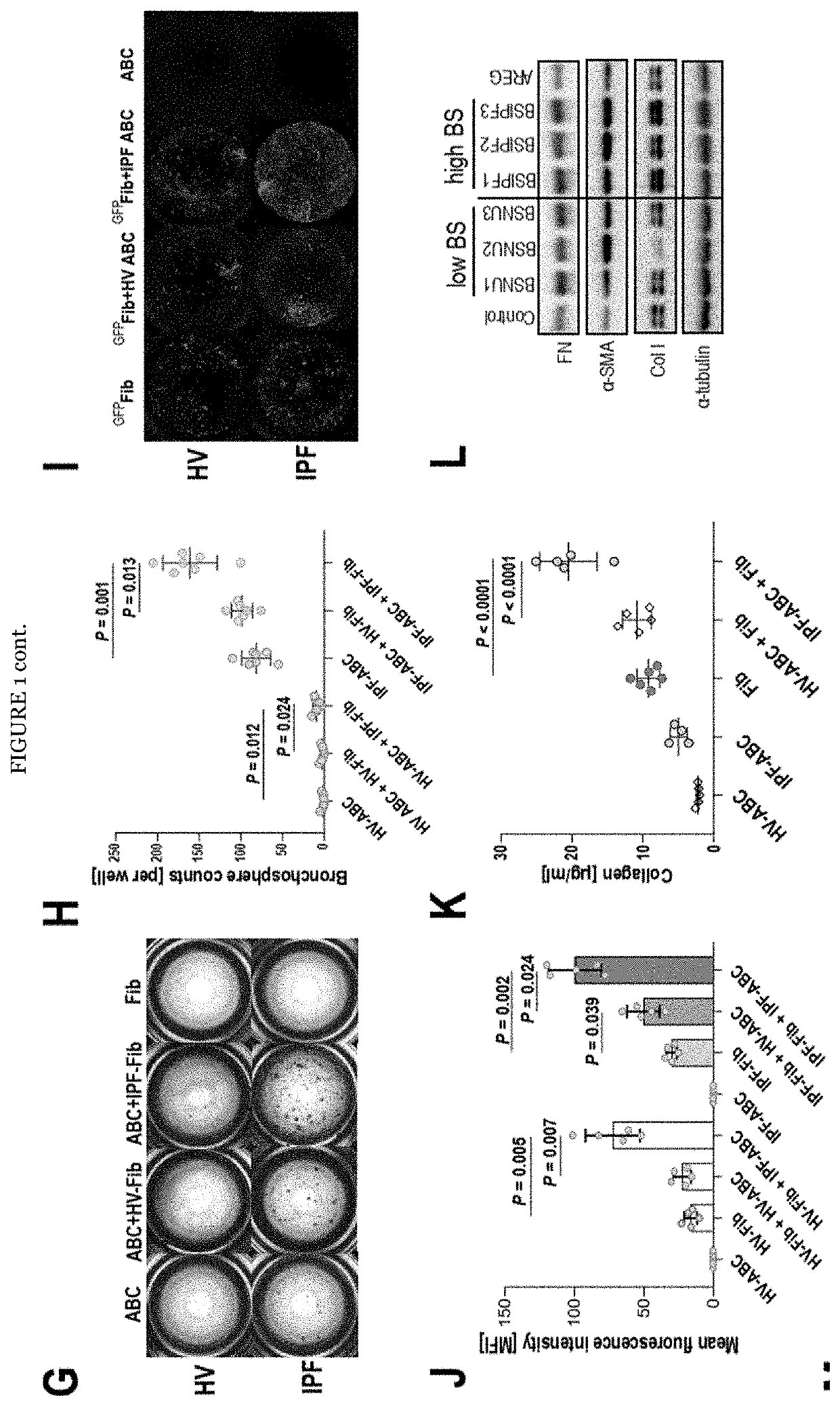 Modulators of airway basal cells for the treatment or prevention of lung diseases