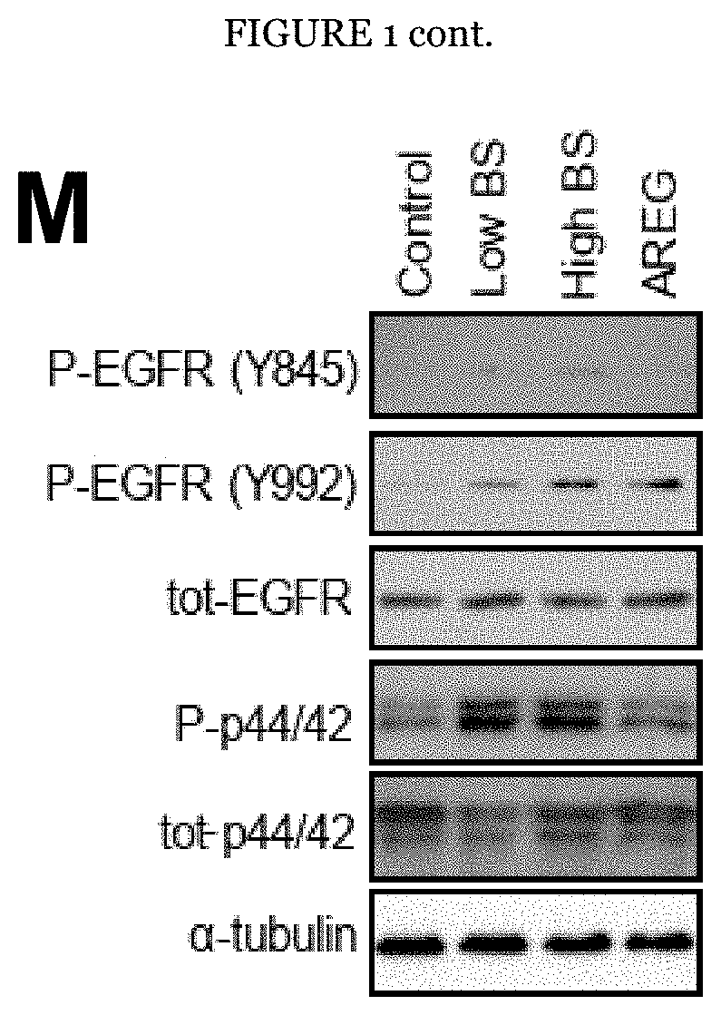 Modulators of airway basal cells for the treatment or prevention of lung diseases