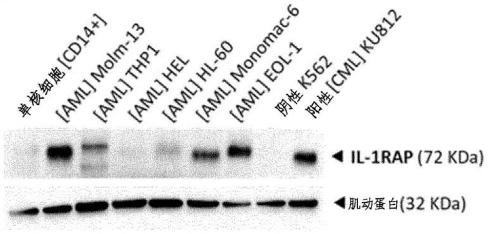 CAR-T cells targeting IL-1RAP and their use in acute myelogenous leukemia (AML)